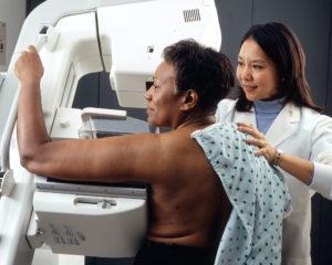 Mammogram Procedure